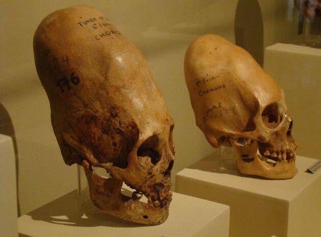 Paracas Skulls