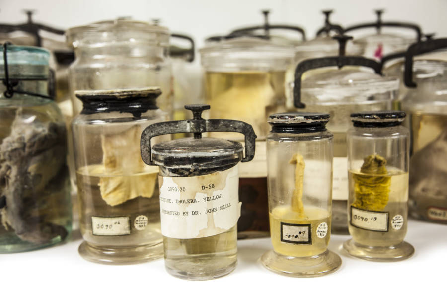 Cholera Wet Specimens