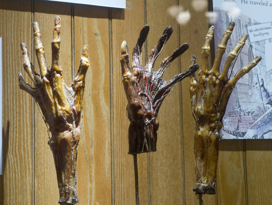 Dried Hands Grimm Anatomy