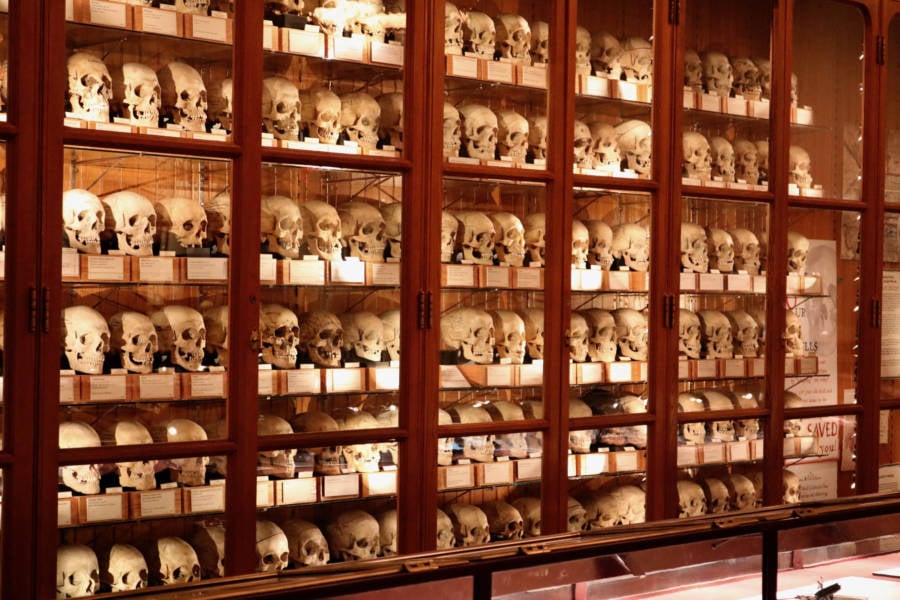 Hyrtl Skull Collection