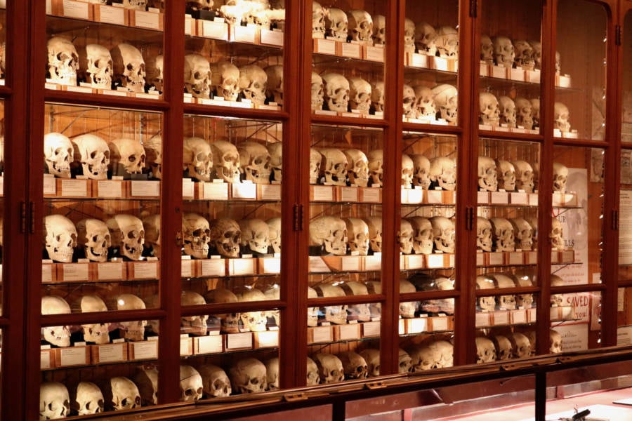 The Mütter Museum's 25 Most Curious And Grotesque Medical Oddities