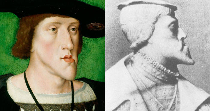 The Habsburg jaw can be attributed to inbreeding - https