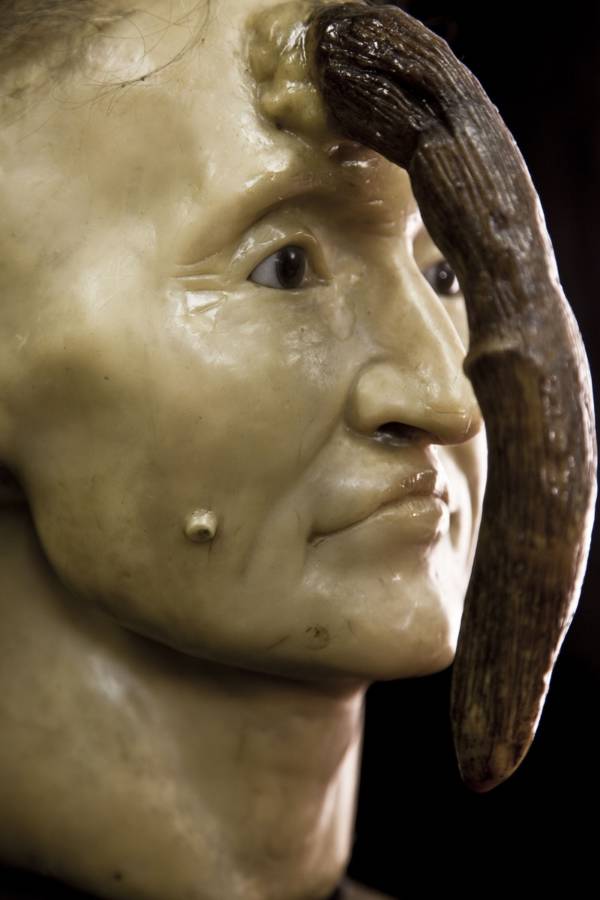 The Mütter Museum's 25 Most Curious And Grotesque Medical Oddities