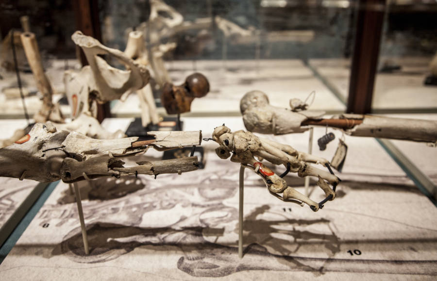 The Mütter Museum's 25 Most Curious And Grotesque Medical Oddities