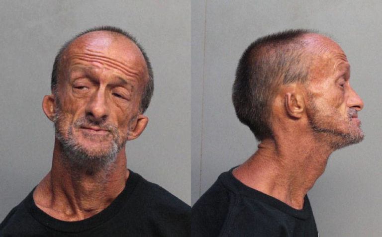Armless Florida Man Arrested For Stabbing Tourist With Scissors