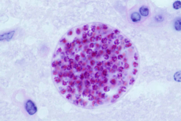 Toxoplasma Gondii Microscope