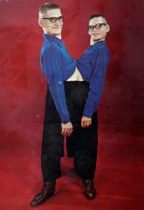 Ronnie And Donnie Galyon: The Longest-Living Conjoined Twins In History