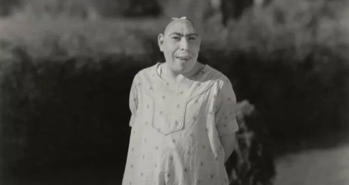 schlitzie-the-sideshow-performer.jpg