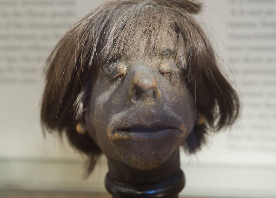 Human Head At The Mutter Museum