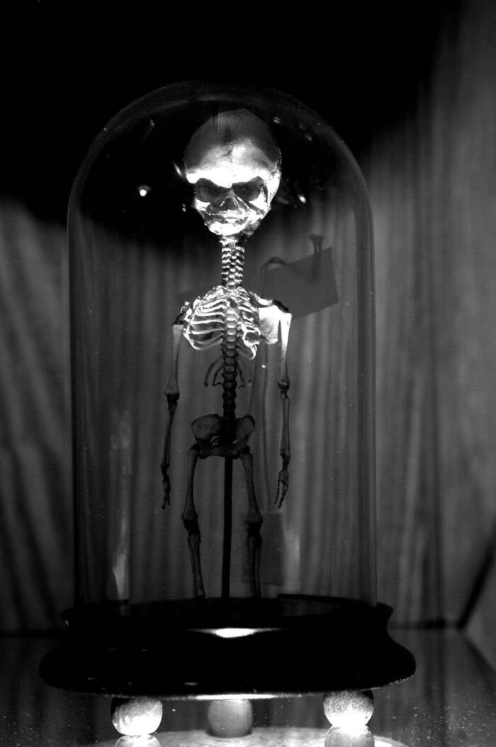 Skeletal Fetus Remains