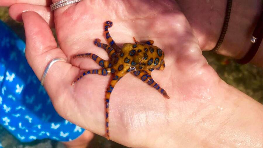 Person In Danger Of Blue Ringed Octopus Bite