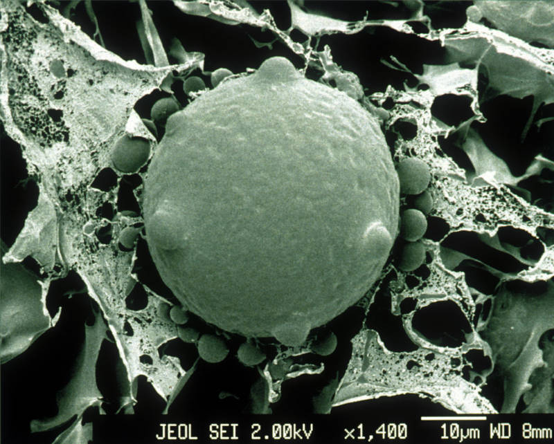 Electron Micrograph Of Batrachochytrium Dendrobatidis Fungus