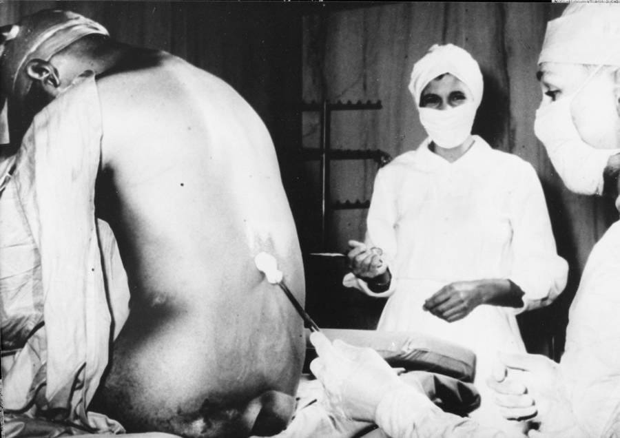 Doctors With Tuskegee Syphilis Study Patient