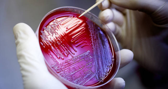 E Coli Petri Dish