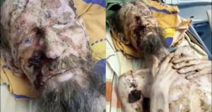 Alexander Bear Victim Hospital Photos