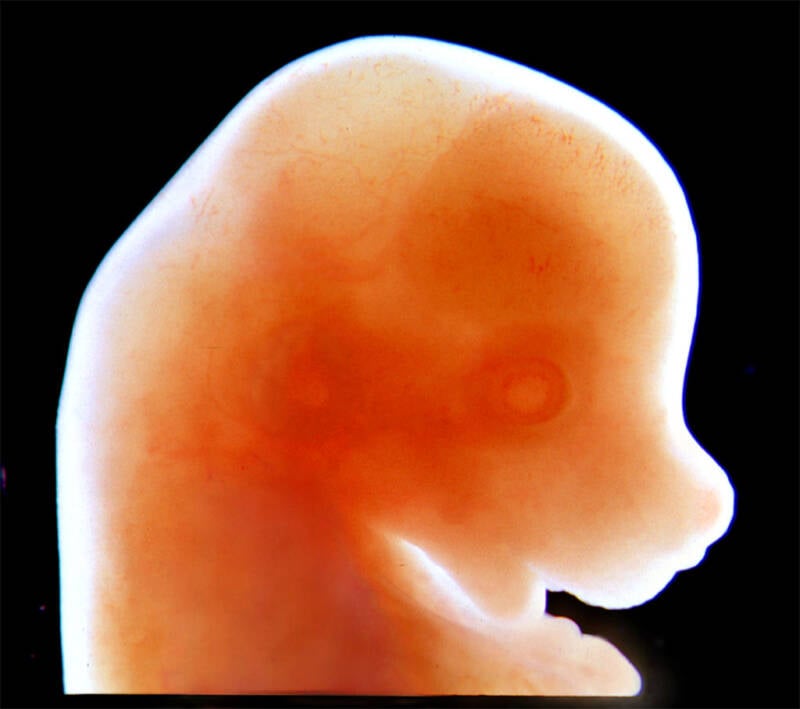 Mouse Embryo