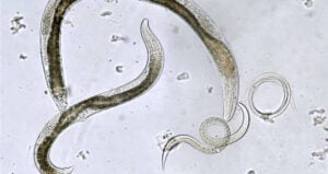 Nematode Worms Swirling Around