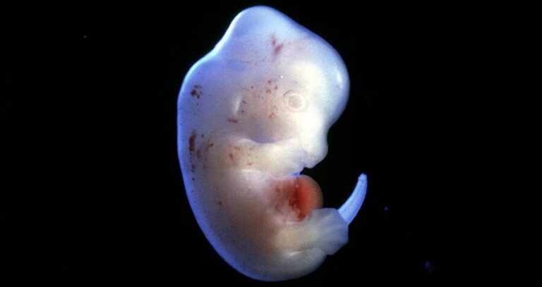 Photo Of Rat Embryo