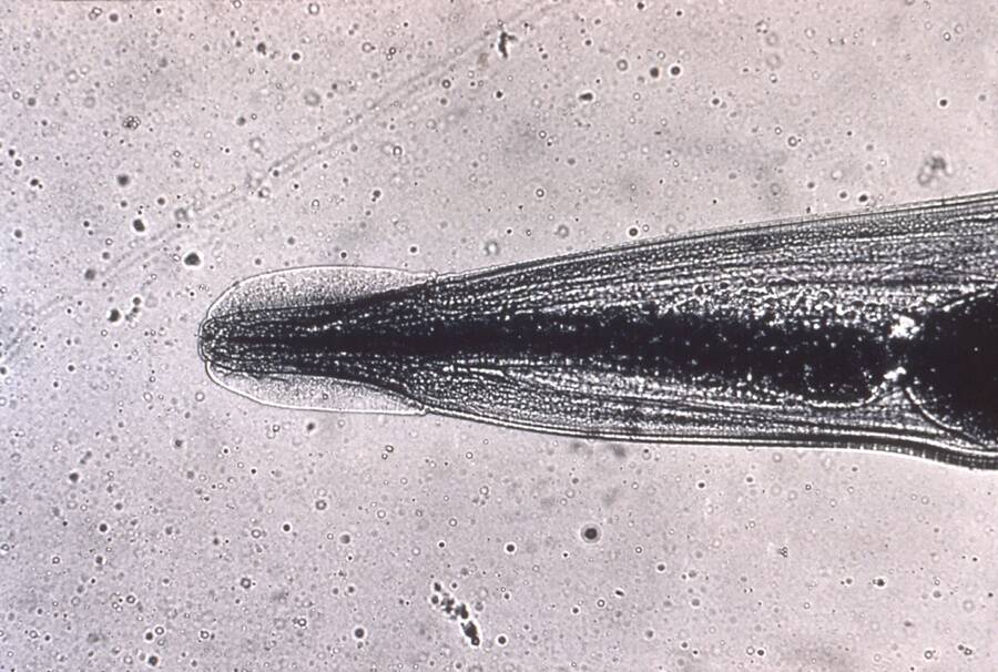 Human Pinworm