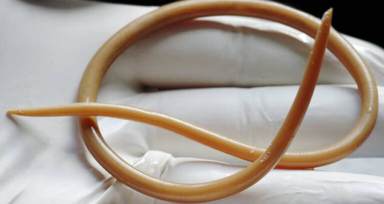 Roundworm In Hand