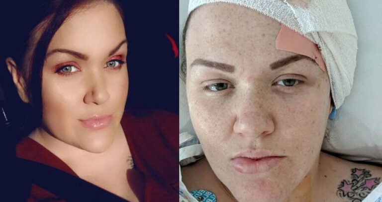 Gemma Cairns Before And After Comparison