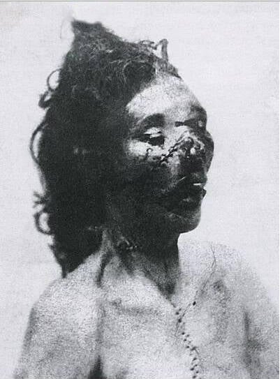 Mortuary Photograph Of Catherine Eddowes