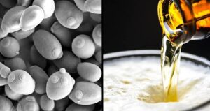 Brewers Yeast Microbes