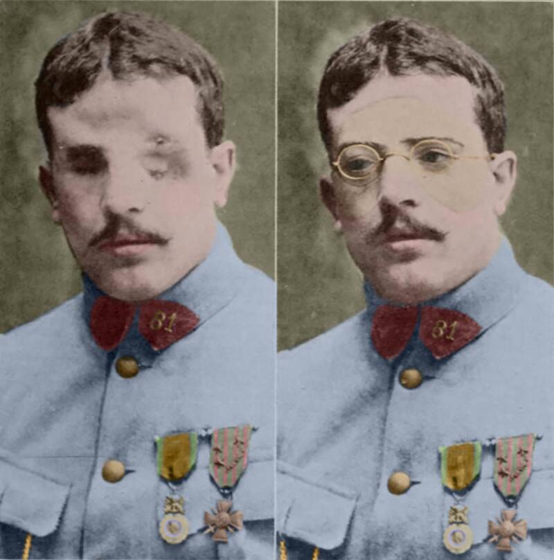 32 Colorized Images That Reveal The Horrors Of World War 1