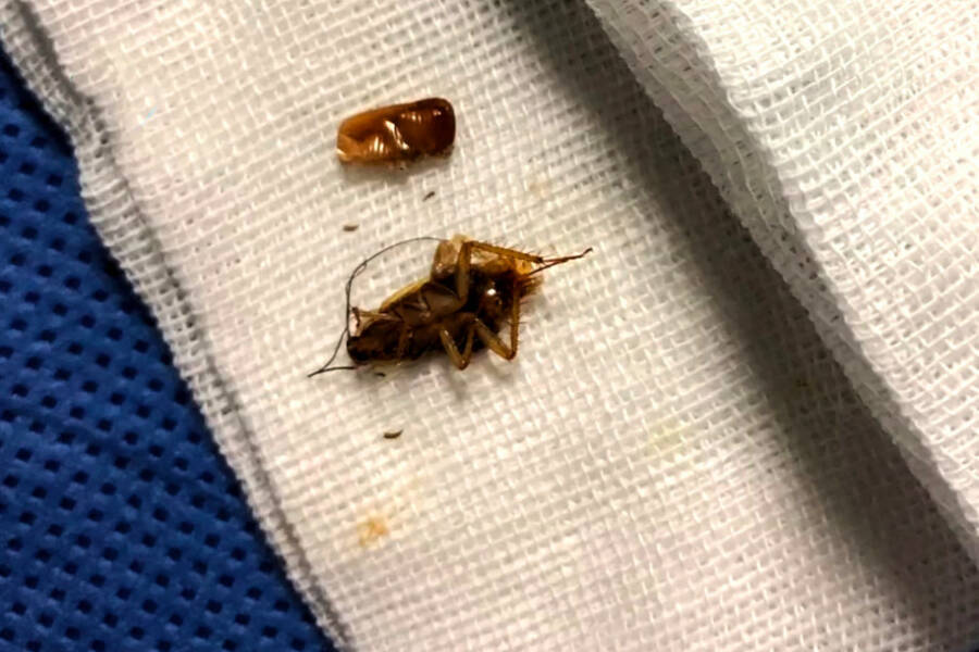 Cockroach After Being Extracted