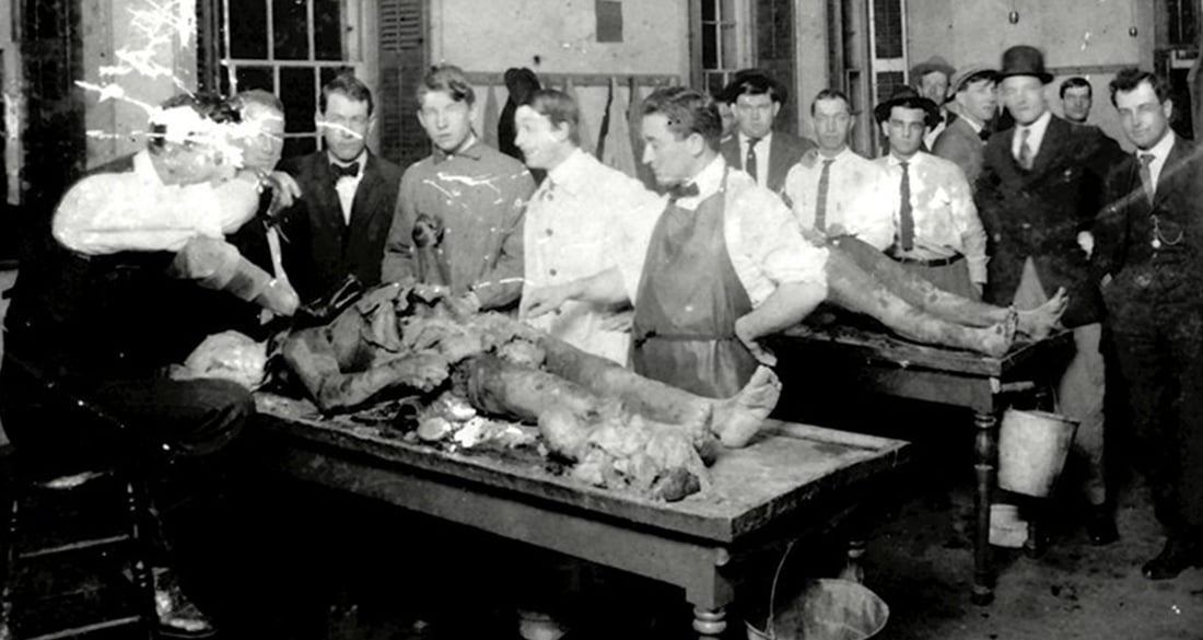 How A Criminal Underworld Of Body-Snatching Corpse Robbers Galvanized Modern Medicine