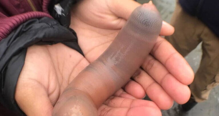 Person Holding Innkeeper Worm