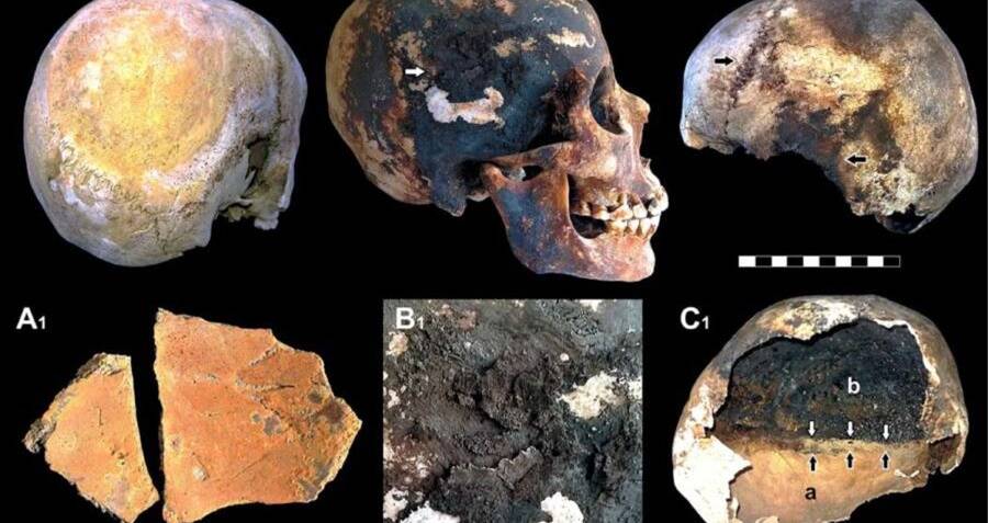 The Vesuvius Eruption Was So Hot It Turned One Man's Brain Into 'Glass'
