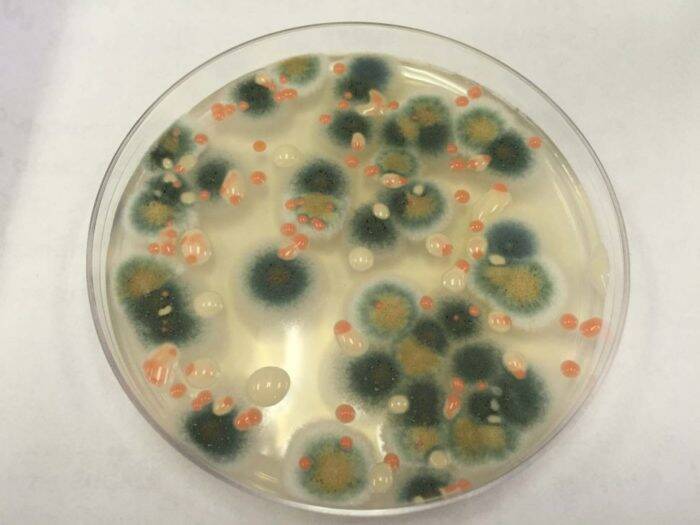 Cepa de hongos negros que se están probando en el laboratorio.