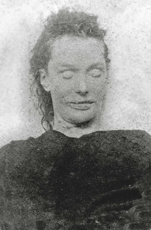 Mortuary Photograph Of Elizabeth Stride