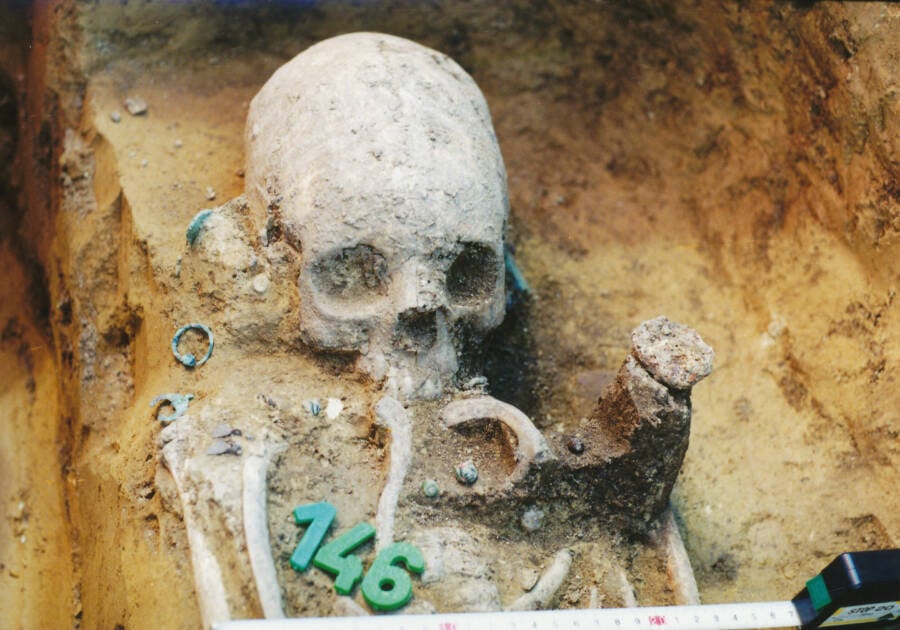 Buried And Deformed Skull In Mözs Icsei Dülö