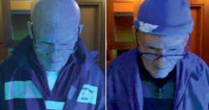 John Colletti Wearing Prosthetics