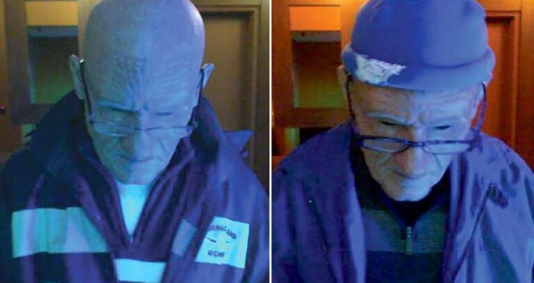 John Colletti Wearing Prosthetics