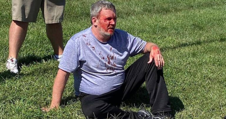 Douglas Lane Bloody On The Ground