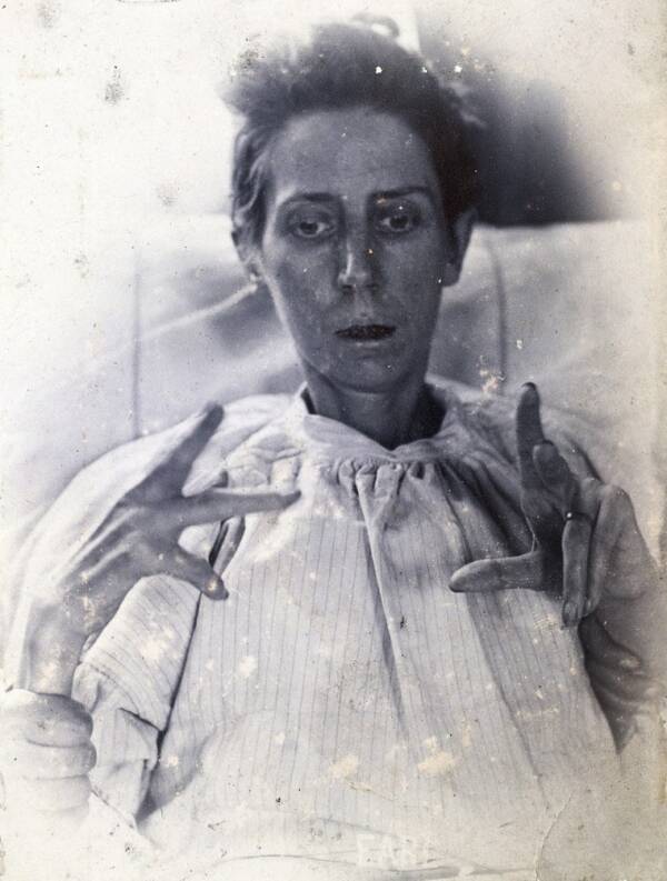 Female Asylum Patient