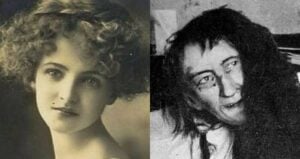 Blanche Monnier Before And After