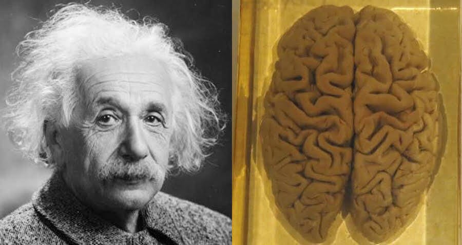 Einstein's Brain