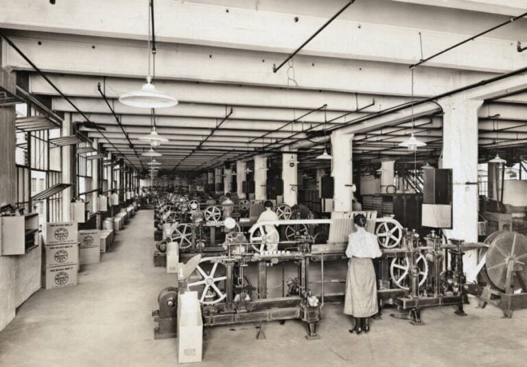 Phossy Jaw How Toxic Phosphorous Disfigured 19thCentury Matchmakers