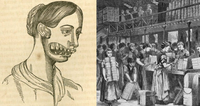 Phossy Jaw vs. Workers