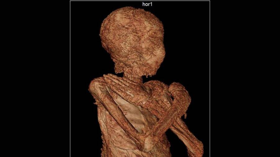 Scan Of Pregnant Mummy