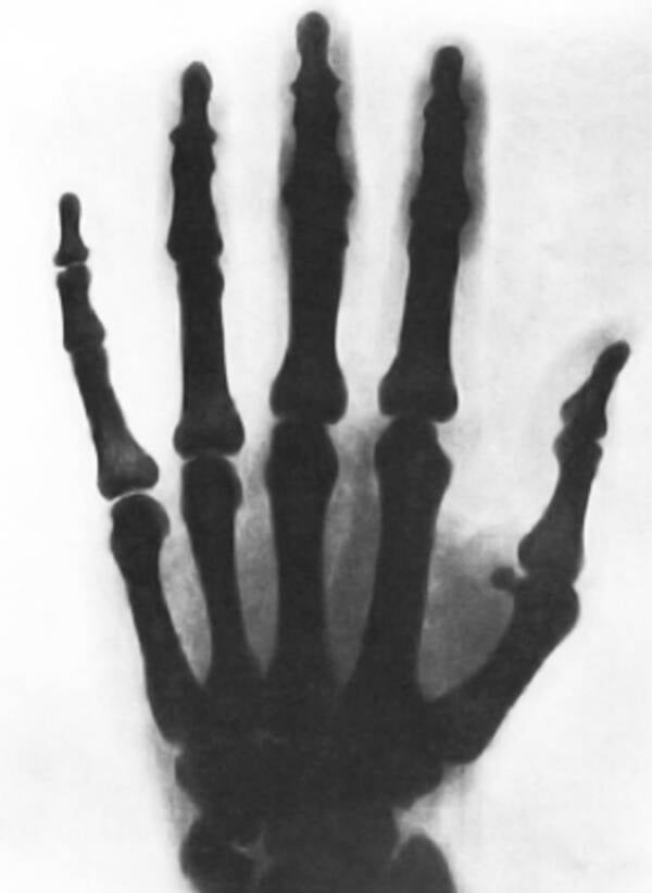 Tesla X Ray