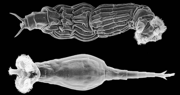 Bdelloid Rotifer