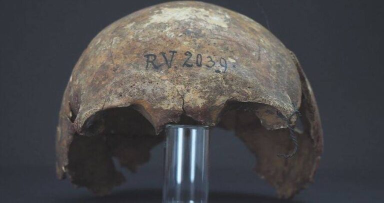 Skull Of Plague Victim