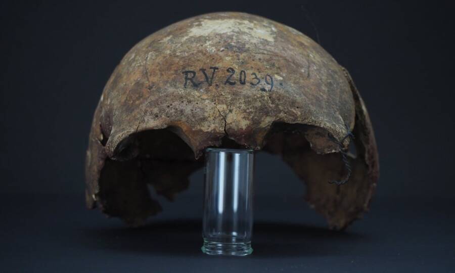 Skull Of First Bubonic Plague Victim