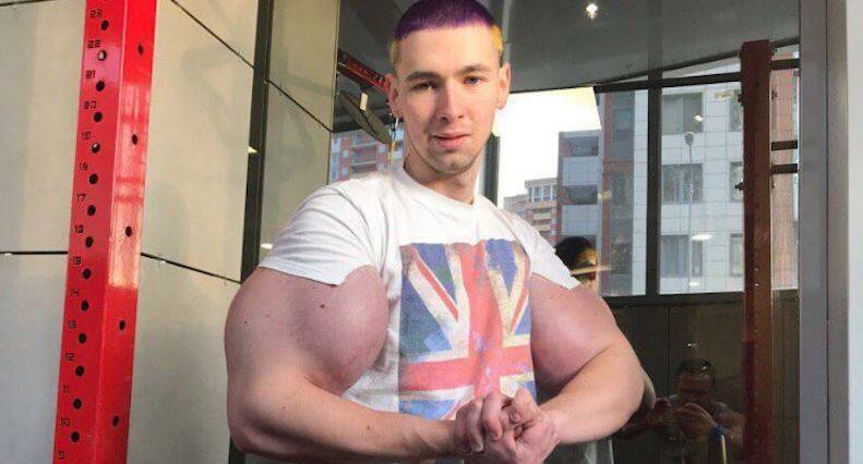 Russian 'Popeye' Proudly Maintains His Synthol-Induced 24-Inch Freakish  Biceps Despite Suffering From Health Issues in the Past - EssentiallySports