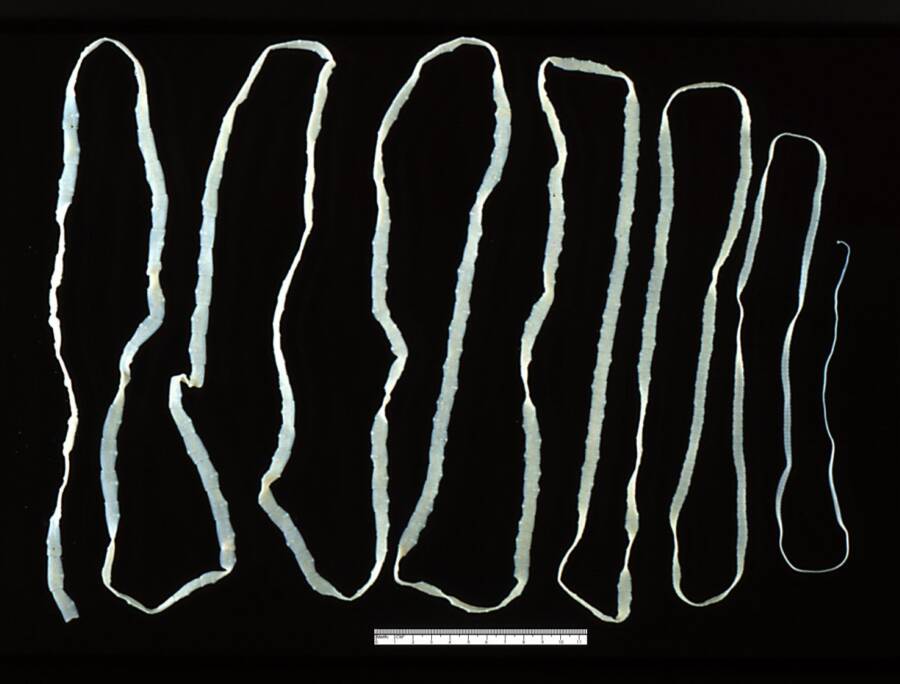 Adult Tapeworm